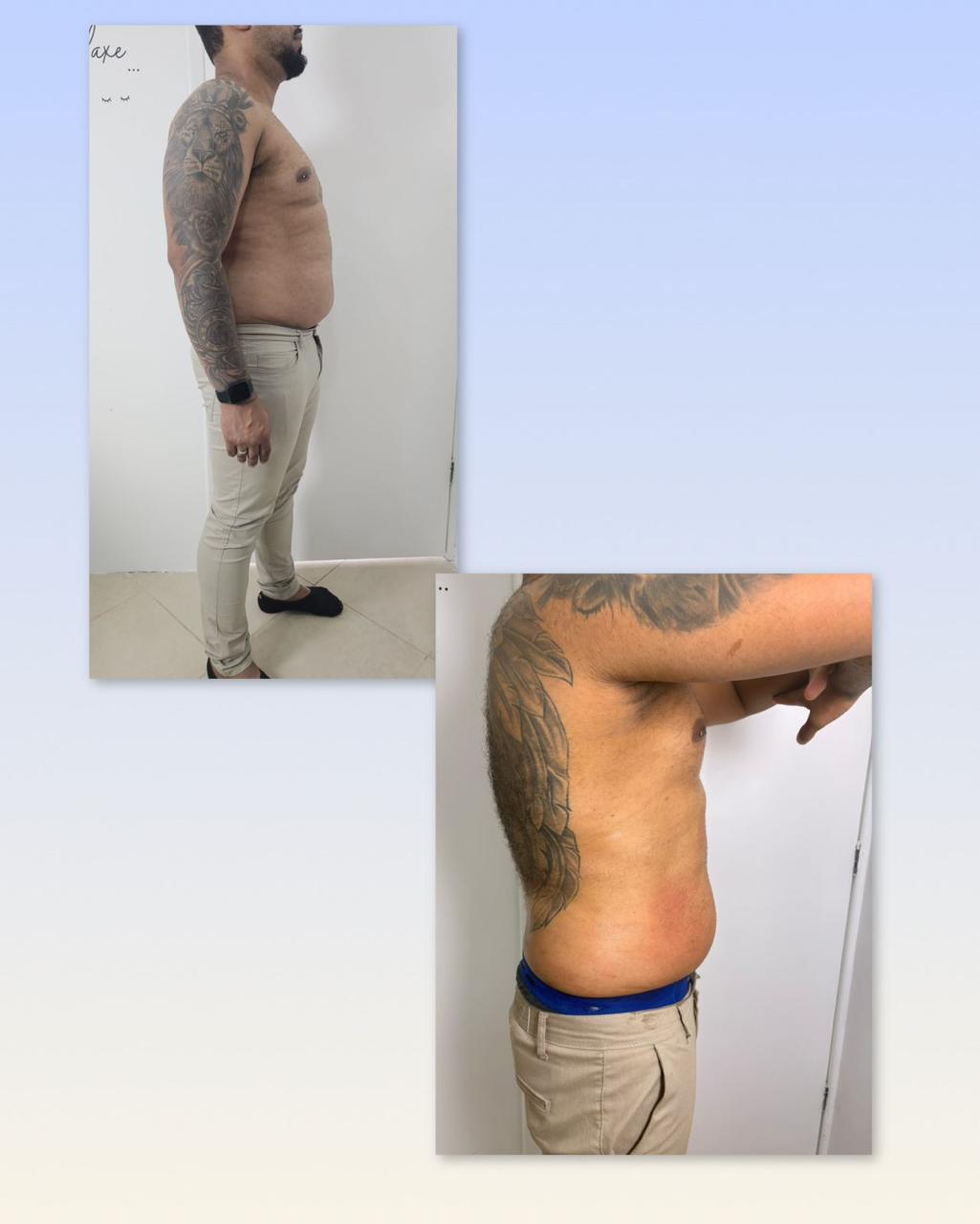 Antes e depois corpo masculino